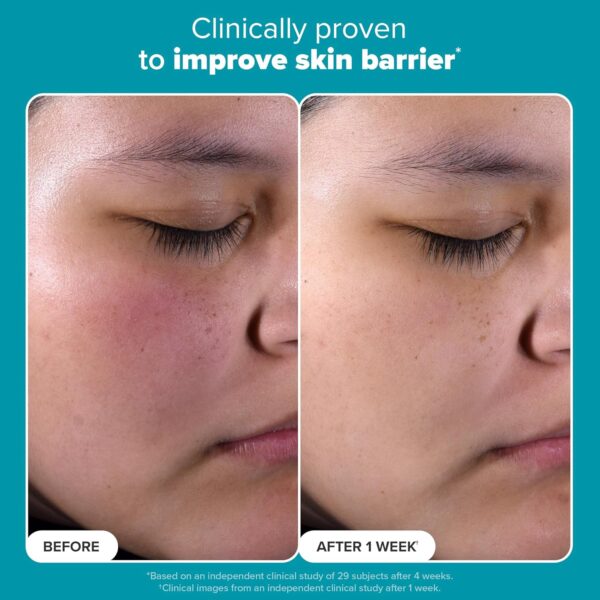 PAULA’S CHOICE SKIN PERFECTING 2% BHA LIQUID EXFOLIANT 30ML - Image 2