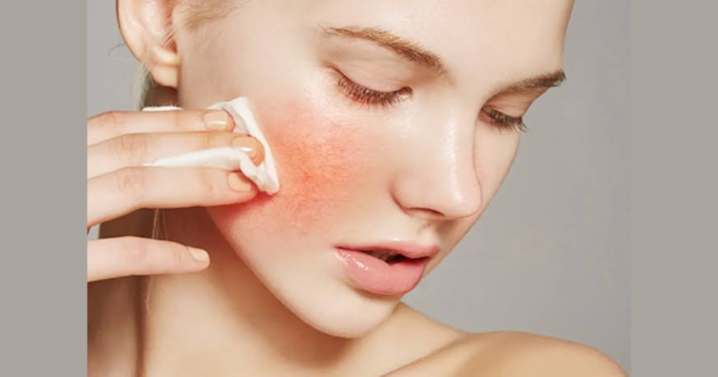 পাতলা স্কিনের যত্ন