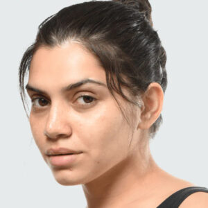 Minimalist Glycolic + Tranexamic 11% Body Exfoliator 30ml