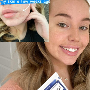 PanOxyl Acne Creamy Wash Benzoyl Peroxide 4% Daily Control 170G