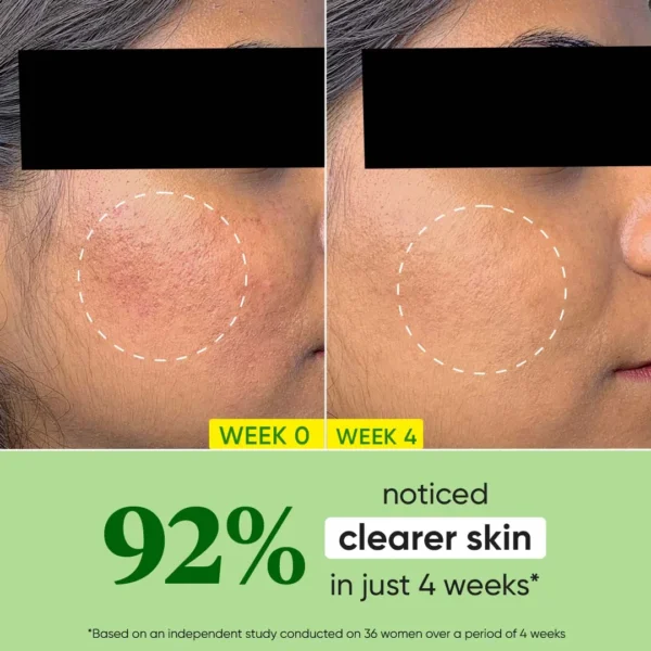 Dot & Key CICA +Niacinamide Oil - Free Moisturizer 60ml - Image 3