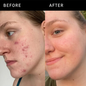 The Inkey List 15% Vitamin C + EGF Serum 30ml