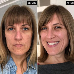 THE INKEY LIST RETINOL SERUM 30ML