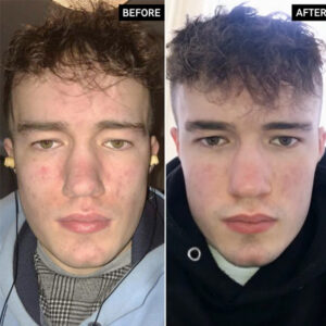 THE INKEY LIST RETINOL SERUM 30ML SALICYLIC ACID CLEANSER 150ML