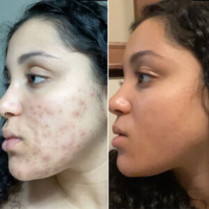 The Inkey List Tranexamic Acid Serum 30ml