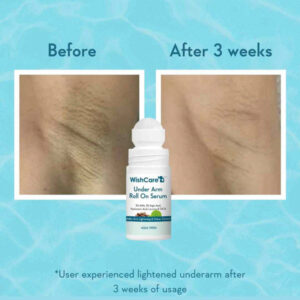 Wishcare Under Arm Roll On Serum - 50ml